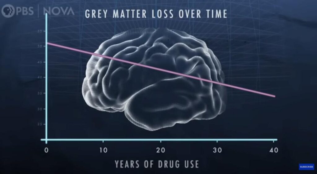 Addiction: The Science Behind (NOVA PBS) 2 A graph depicting grey matter loss over time and how it declines steadily with years of drug use.